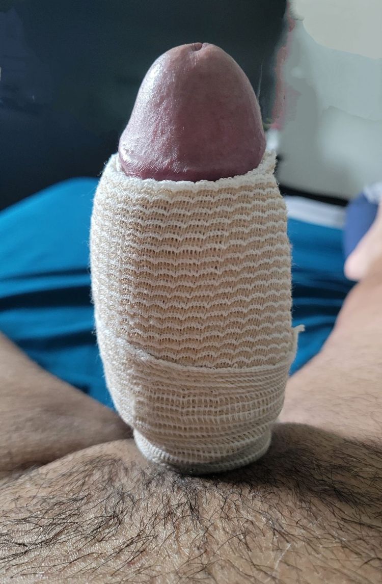 Guevo fracturado y recuperado esperando masaje 1 Guevo fracturado y recuperado esperando masaje